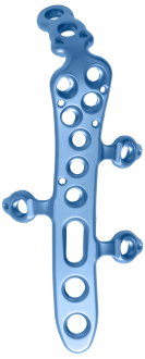 Hofer_Medical_Solutions_Olekranon_Laschen